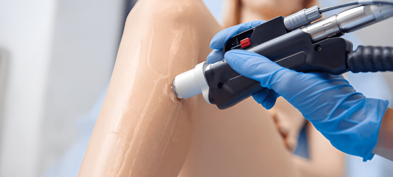 Body Laser Treatment