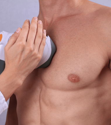 Torso Lower Laser Hair Removal