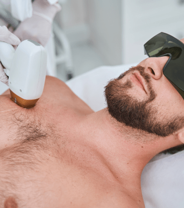 Body Laser Hair Removal